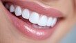 © Ilona - A close-up view shows a person smiling, showcasing bright white teeth and well-groomed lips. The natural lighting enhances the healthy appearance, emphasizing dental aesthetics and personal care
