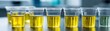 © Thamonchanok - Urinary frequency with urine output concept. Colorful liquid samples in laboratory cups for analytical testing.