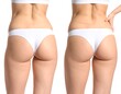 © Aditya - Before and after body transformation (1)