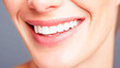 © Ali - Close-up of a happy woman smiling with perfect white teeth, close-up on her mouth and healthy smile