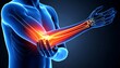 © Tas - 3D anatomical rendering of male elbow with highlighted pain