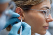© Olha Havelia - Close-up of patient ear during earwax removal procedure, medical precision,
