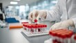 © Justlight - Side view of a focused laboratory technician arranging blood samples on a tray while working in a modern diagnostic testing laboratory.