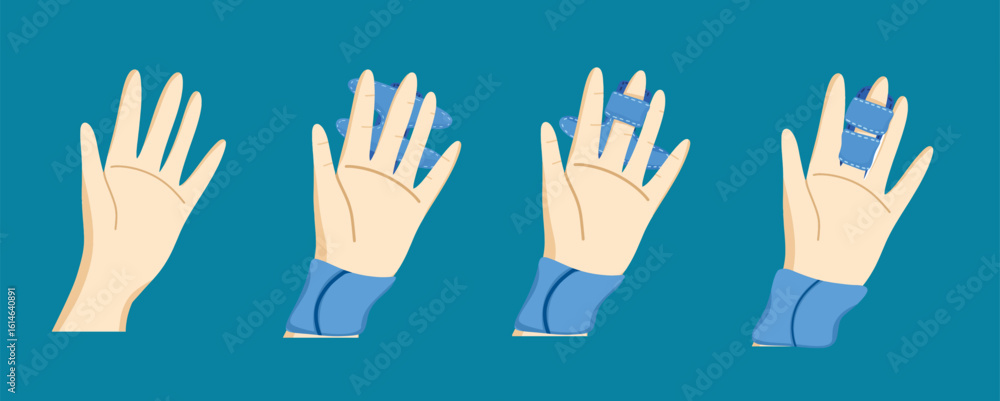 Finger Injury First Aid Step-by-Step Finger Bandage Tutorial for Hand Injury Care Stock Vector ...