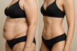 © foto Art - Side view female abdomen before and after body transformation showing major fat loss and toned core with visible waistline, studio lighting