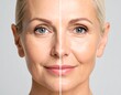 © Irawan - Before-and-after comparison of a woman's face, highlighting the reduction of wrinkles and signs of aging