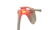 © Nadira - Shoulder joint inflammation depicted with red glow on bones in a medical illustration on white