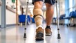 © Ramadhana - A person with a leg injury walks down a hospital corridor, using crutches for support.
