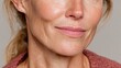 © Iurii - Close-up of a mature woman's jowl area highlighting age-related skin changes