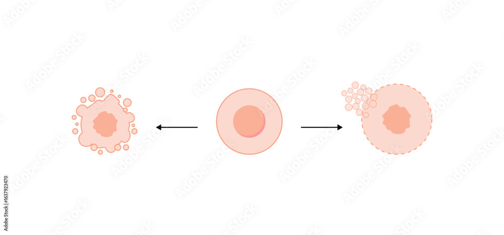 Necrosis and apoptosis of normal cell. cell death labeled outline ...