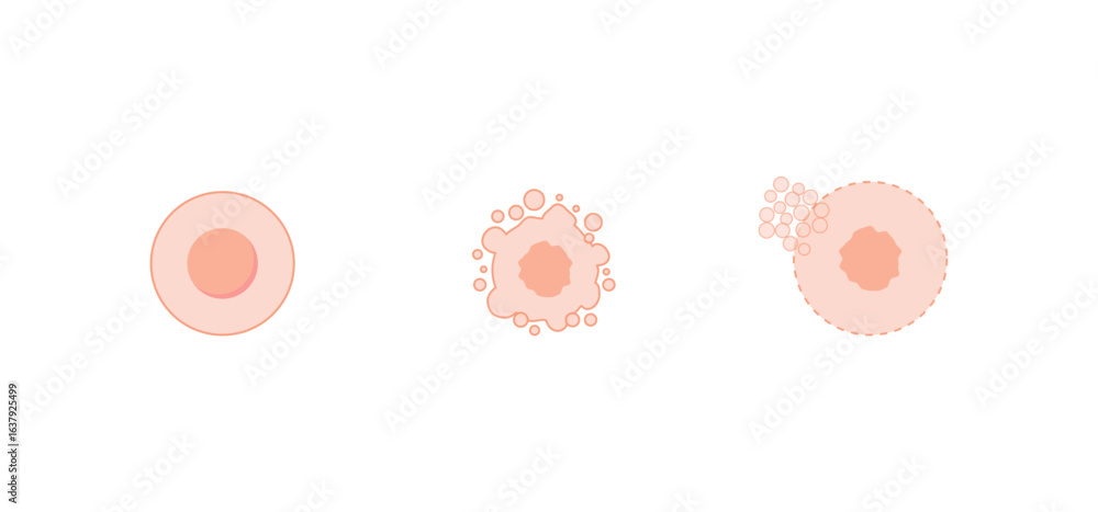 Necrosis and apoptosis of normal cell. cell death labeled outline ...