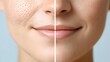 © Yuliia - Close up view of facial skin texture showing pores and smoothness comparison with dividing line demonstrating skincare treatment results for beauty and cosmetic industry.