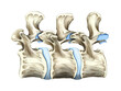 © Science RF - lower spine bones, illustration