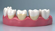 © ModernFiles - Artificial Teeth Different Materials Zirconia Porcelain Composite