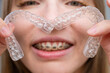 © Михаил Решетников - Woman with braces on her teeth holding and removable transparent aligners.
