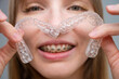 © Михаил Решетников - Woman with braces on her teeth holding and removable transparent aligners.
