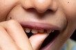 © Alessandro Grandini - Child touching loose tooth with finger: close-up of mouth and nose