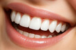 © Rajashree_75 - Professional teeth whitening treatment for bright and confident smile