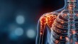 © alex - Medical illustration of human shoulder pain highlighted in a close-up view with blue background, focusing on shoulders and upper arms
