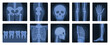 © Flash Vector - Xrays films of human body set, radiography and anatomy vector illustration. Cartoon isolated medical roentgen scans with silhouettes of bones of skeleton, joint and articulation of legs and hands
