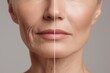 © Sathaporn - Close-up of mature woman face showing anti-aging skincare before and after effect