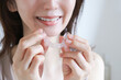© webbiz - マウスピースをつける女性