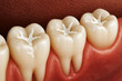 © Babla - Healthy teeth with fillings in gums dental