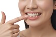 © Risat Designer - A young woman with a bright white smile points to her teeth showcasing healthy gums and dental hygiene
