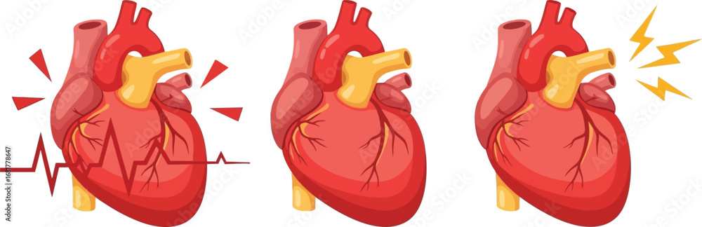 Heart Condition Visual Understanding heart health conditions and cardiovascular system care ...