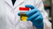 © RUMA - Person in blue gloves holds clear specimen cup with yellow liquid medical laboratory