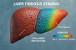 © RyujinxRyuken - Liver Fibrosis Staging Illustration: Collagen Deposition, Elastography, and Severity Spectrum [Illustration]