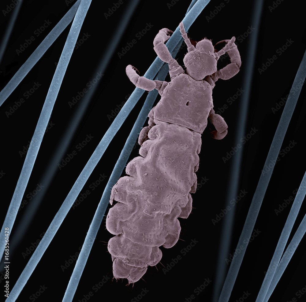 SEM images of head lice (Pediculus humanus capitis) on hair Stock Photo ...
