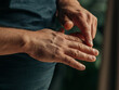 © Masson - Close-up of a middle-aged man hands highlighting dry skin