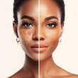 © pixelliebe - Beautiful young woman before and after acne treatment. Skin care concept