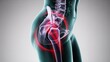 © Marc - An anatomical view of a body highlighting the hip and joint pain.