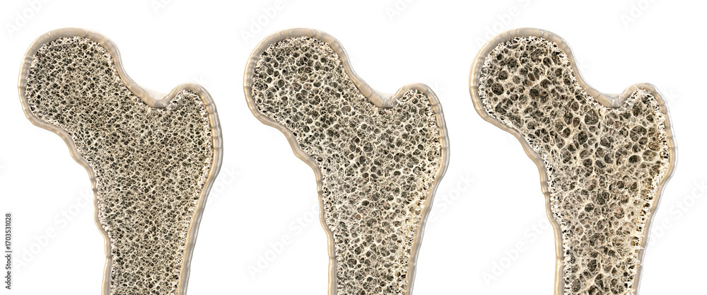 3D cross-section of human bone structure with varying density ...