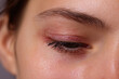 © Marut - Close up view of red irritated skin on closed eye showing detailed texture and eyelashes, highlighting natural skin condition and subtle eyebrow hair