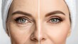 © Harmony of Forms - Before and After Eyelid and Facelift Surgery – Dramatic Eye Lift and Facial Rejuvenation Transformation