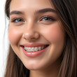 © Frederick - Closeup of woman with braces on teeth with elastics. Smiling face with braces isolated on white background. Orthodontic treatment. Closeup of healthy female mouth with metal braces.