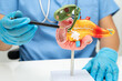 © Warawan - Pancreatitis, pancreatic cancer, Asian doctor with pancreas, gallbladder and bile duct human anatomy model at hospital.