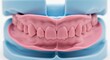 © Kristelinmind - Dental model of human teeth in orthodontic blue base