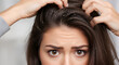 © Passionwith - Woman with Dandruff Problem, Itchy Scalp and Hair Loss