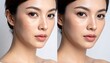 © Cendet - Before and after skin image comparison