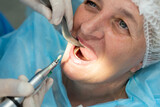  male dentist surgeon in uniform with assistant doing operation for install dental implant teeth of eldery woman