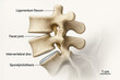 © Udi - Anatomical illustration of lumbar spine showing spondylolisthesis, facet joint, and intervertebral disc