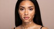 © Agus Through Lens - A beautiful and confident woman with vitiligo looking directly at the camera. A portrait celebrating skin positivity, diversity, uniqueness, and self-acceptance