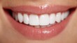 © KN Studio - Smiling lips and teeth: A close-up shot of a radiant smile, revealing perfectly aligned, pearly white teeth, framed by full, glossy lips. Capturing dental perfection and happiness.