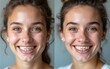 © wang - Closeup shot of young woman before and after dental braces, two years apart. High quality