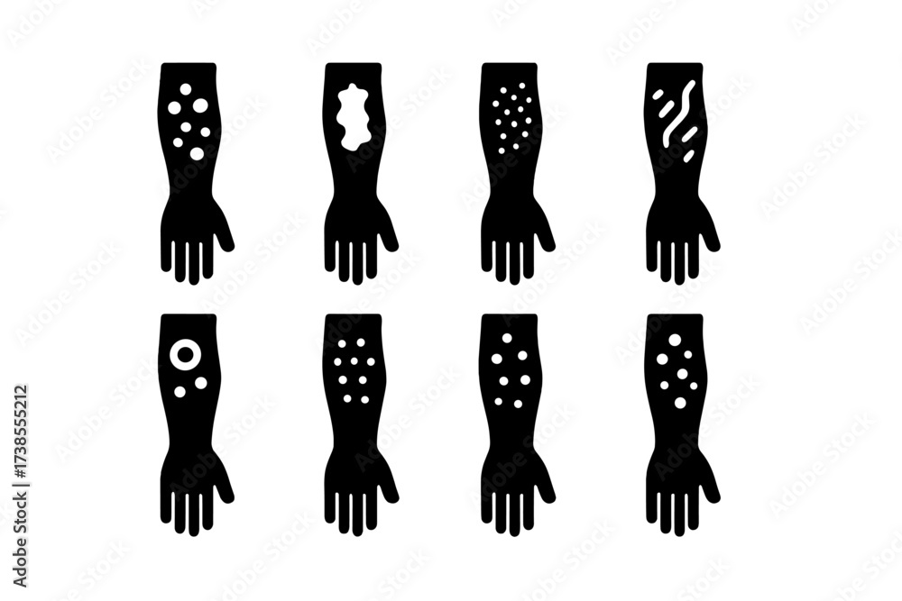 Stock-Vektorgrafik „Rash Type Icons. Solid, filled icon set of rash ...