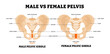 © vesvocrea - Male vs Female pelvis structure diagram. Healthcare poster design. Anatomy of human pelvic bone. Main difference with girdle,sacrum, coccyx, symphysis, ischium, ilium, iliac,pubic arch narrow and wide